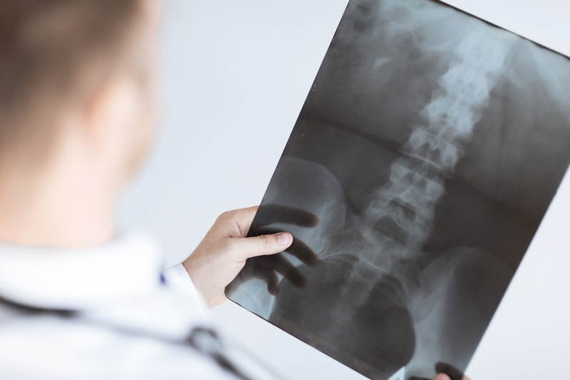 LA Back Injury Attorney