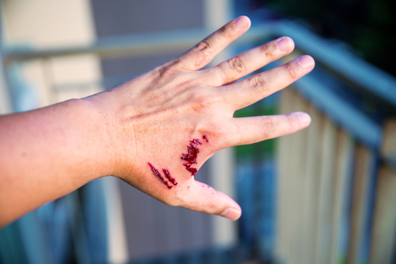 LA Dog Bite Injury Lawyer